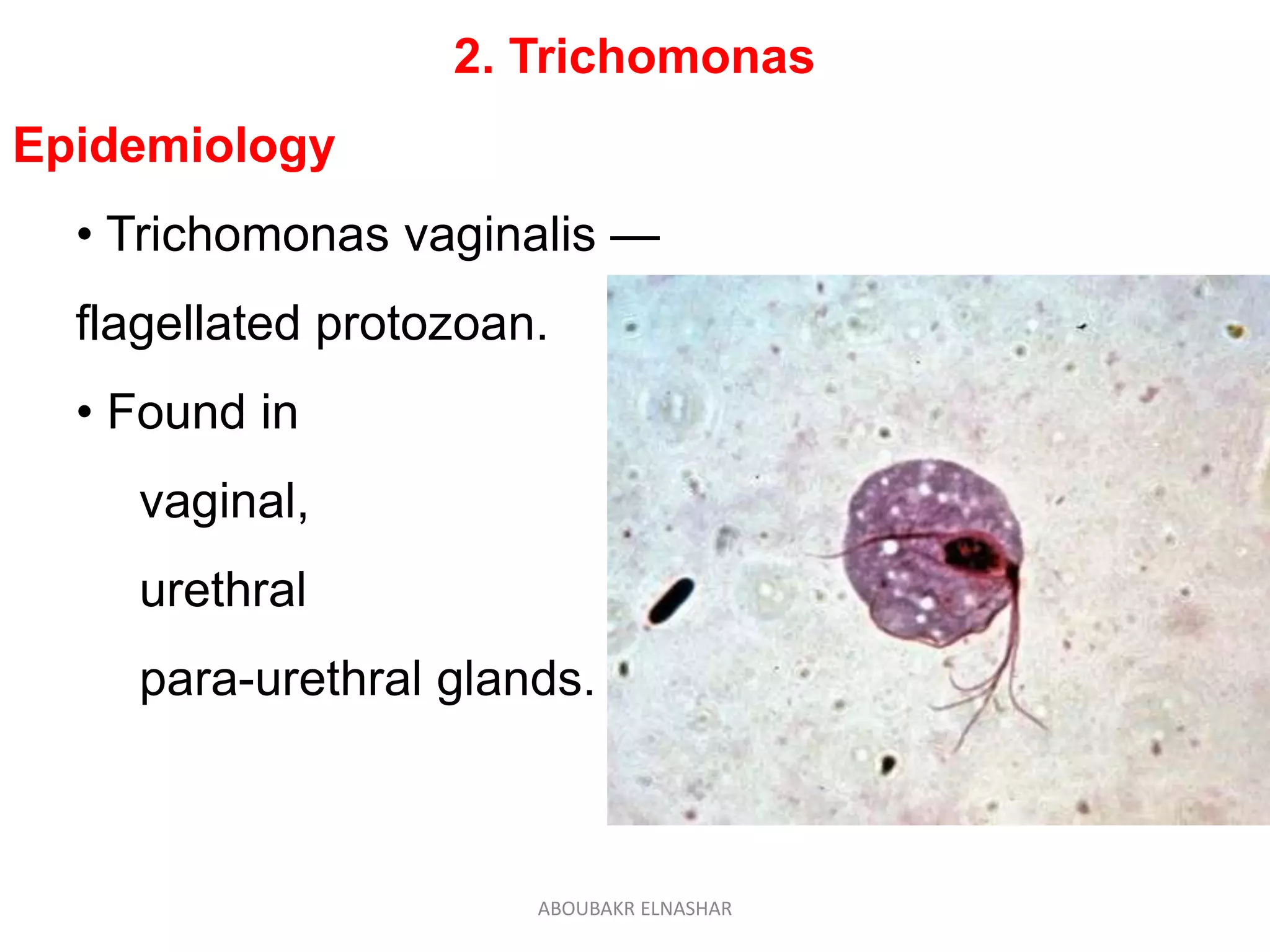 2. Trichomonas
Epidemiology
• Trichomonas vaginalis —
flagellated protozoan.
• Found in
vaginal,
urethral
para-urethral glands.
ABOUBAKR ELNASHAR
 
