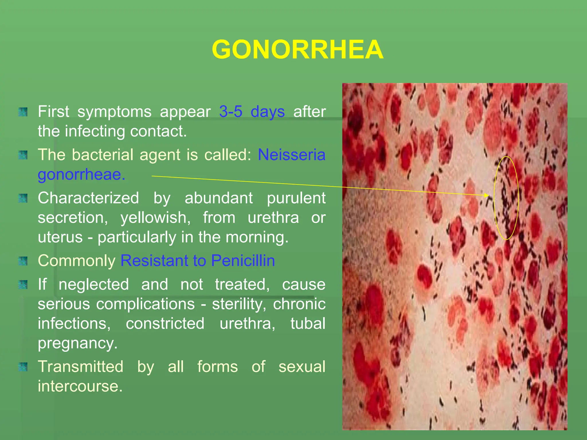 GONORRHEA
First symptoms appear 3-5 days after
the infecting contact.
The bacterial agent is called: Neisseria
gonorrheae.
Characterized by abundant purulent
secretion, yellowish, from urethra or
uterus - particularly in the morning.
Commonly Resistant to Penicillin
If neglected and not treated, cause
serious complications - sterility, chronic
infections, constricted urethra, tubal
pregnancy.
Transmitted by all forms of sexual
intercourse.
 