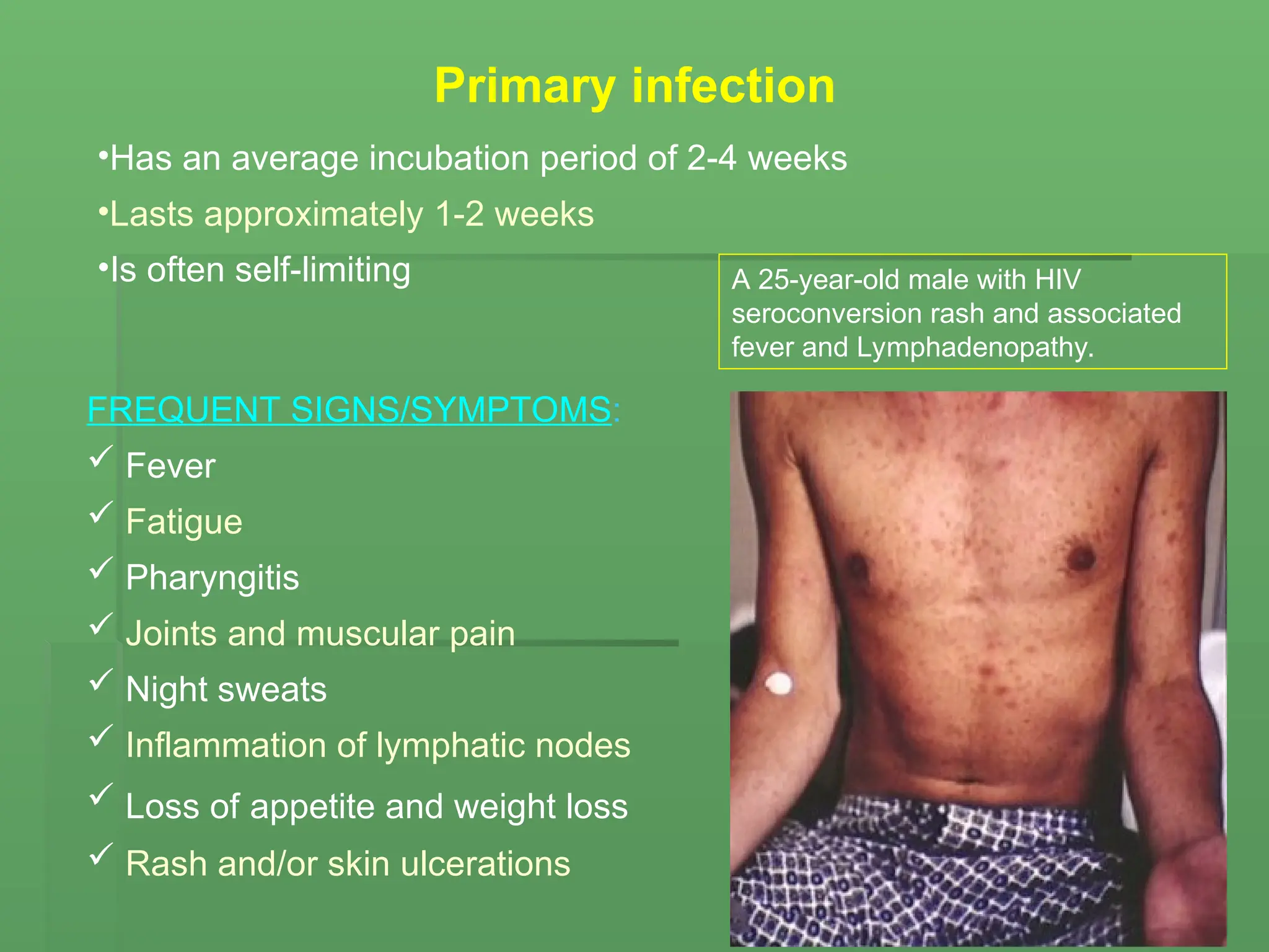 FREQUENT SIGNS/SYMPTOMS:
 Fever
 Fatigue
 Pharyngitis
 Joints and muscular pain
 Night sweats
 Inflammation of lymphatic nodes
 Loss of appetite and weight loss
 Rash and/or skin ulcerations
Primary infection
•Has an average incubation period of 2-4 weeks
•Lasts approximately 1-2 weeks
•Is often self-limiting A 25-year-old male with HIV
seroconversion rash and associated
fever and Lymphadenopathy.
 