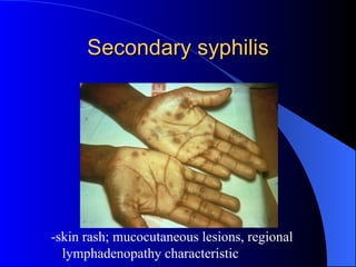 Secondary syphilis -skin rash; mucocutaneous lesions, regional lymphadenopathy characteristic 