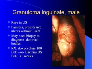 Granuloma inguinale, male Rare in US Painless, progressive ulcers without LAN May need biopsy to diagnose- donovan bodies RX: doxycycline 100 BID –or- Bactrim DS BID, 3+ weeks 