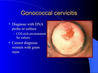 Gonococcal cervicitis Diagnose with DNA probe or culture CO2-rich environment for culture Cannot diagnose women with gram stain 