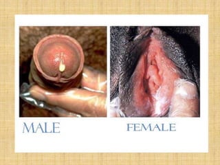 Sexually Transmitted Diseases