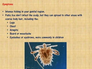 Sexually Transmitted Diseases