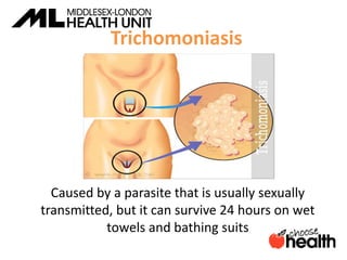 Trichomoniasis
Caused by a parasite that is usually sexually
transmitted, but it can survive 24 hours on wet
towels and bathing suits
 