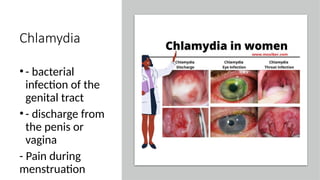 Chlamydia
•- bacterial
infection of the
genital tract
•- discharge from
the penis or
vagina
- Pain during
menstruation
 