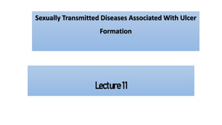 Sexually Transmitted Diseases Associated With Ulcer
Formation
Lecture11
 