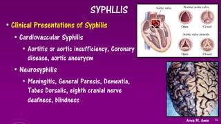 Sexually Transmitted Diseases (STDs): Bacterial STDs | PDF