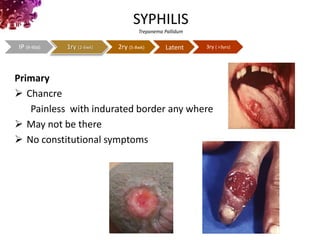 sexual transmitted diseases and the emergency room | PPTX