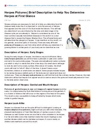st dt ips.co m

http://stdtips.co m/herpes-pictures-brief-descriptio n-to -help-yo u-determine-herpes-at-first-glance/

Herpes Pictures | Brief Description to Help You Determine
Herpes at First Glance
STD Tips

Octo ber 10, 2013

Herpes pictures are necessary to look at to help you determine how the
disease really looks like. It is important to note the amount of blisters
that appears and the color of the f luid inside the blisters. T his will help
you determine if you are inf ected by the virus and what stage in the
disease cycle you are already in. Herpes is considered as one of the
most common sexually transmitted diseases in the world. It is a viral
disease that is caused by Herpes Simplex Virus. T he af f ected body part
will determine the category of herpes. It can manif est on the mouth, on
the genitals, and other parts of the body. T here are many dif f erent
pictures of herpes you can f ind online which will help you determine if a
growing blister in certain parts of your body can be classif ied as one.

Description of Herpes: Early Stages
During the early stages of herpes, the blisters may look dif f erent. Many
early herpes pictures you will f ind have a yellowish or pale color center
and red in the surrounding areas. T he pale colored/yellowish center contains
pus which is why it is raised. But af ter a f ew days, the small ulcers will begin
to look dry and f orm a crusty surf ace. Af ter about 2-3 weeks, the dried
crusts will start to f all of f . Most of the time, it doesn’t leave a scar.
Sometimes, blisters or small ulcers are absent. Some people mistake herpes
to be rashes because reddish parts of the body are not raised and does not
contain pus. T here are herpes rash pictures you will f ind that look like ordinary rashes. However, the main
distinction will be that herpes f irst appear around a narrow area in the spine and eventually extend in f ront
to the belly and/or chest area.

Description of Herpes: Genital and Mouth Herpes
Pictures of genital herpes in men and images of vaginal herpes look the
same. It is characterized by f luid-f illed blisters f orming around the genitals. It
is a cluster of blisters that will occur on the vagina or the head of the penis.
T he mouth is also susceptible to being af f ected by herpes which looks
similar to genital herpes.

Herpes Look-Alike
Herpes is a disease that can be quite dif f icult to distinguish. Looking at
herpes simplex virus pictures, might conf use you with other diseases. T he
physical manif estation of f luid-f illed blisters of rashes occurs in other
diseases as well. Canker sores are one that is of ten mistaken to be herpes.
It is f lat and white sores that manif est inside the mouth. Impetigo is also
another disease which can be mistaken as herpes. It occurs mainly on
children and manif ests around the mouth.

 