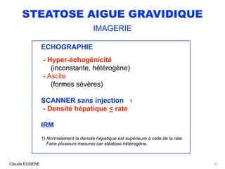 STEATOSE AIGUE GRAVIDIQUE
IMAGERIE
ECHOGRAPHIE
- Hyper-échogénicité 
(inconstante, hétérogène) 
- Ascite
(formes sévères)
SCANNER sans injection
- Densité hépatique < rate
1
IRM
1) Normalement la densité hépatique est supérieure à celle de la rate. 
Faire plusieurs mesures car stéatose hétérogène.
10Claude EUGENE
 