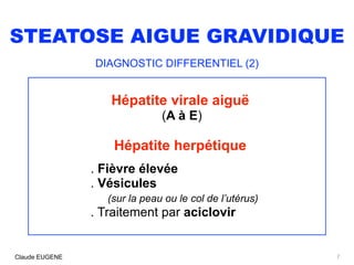STEATOSE AIGUE GRAVIDIQUE
DIAGNOSTIC DIFFERENTIEL (2)
Hépatite virale aiguë
(A à E)
Hépatite herpétique
. Fièvre élevée 
. Vésicules  
(sur la peau ou le col de l’utérus) 
. Traitement par aciclovir
7Claude EUGENE
 
