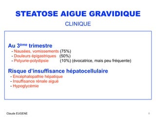 STEATOSE AIGUE GRAVIDIQUE
CLINIQUE
Au 3ème trimestre
- Nausées, vomissements (75%)
- Douleurs épigastriques (50%)
- Polyurie-polydipsie (10%) (évocatrice, mais peu fréquente)
Risque d’insuffisance hépatocellulaire
- Encéphalopathie hépatique
- Insuffisance rénale aiguë
- Hypoglycémie
8Claude EUGENE
 