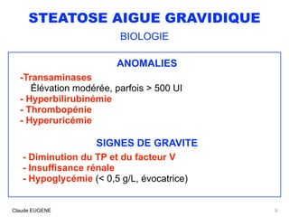 STEATOSE AIGUE GRAVIDIQUE
BIOLOGIE
ANOMALIES
-Transaminases
Élévation modérée, parfois > 500 UI
- Hyperbilirubinémie
- Thrombopénie
- Hyperuricémie
SIGNES DE GRAVITE
- Diminution du TP et du facteur V
- Insuffisance rénale
- Hypoglycémie (< 0,5 g/L, évocatrice)
9Claude EUGENE
 