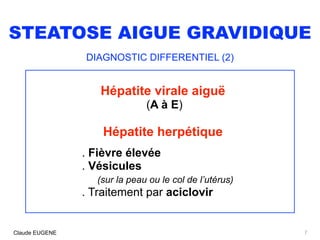 STEATOSE AIGUE GRAVIDIQUE
DIAGNOSTIC DIFFERENTIEL (2)
Hépatite virale aiguë
(A à E)
Hépatite herpétique
. Fièvre élevée 
....