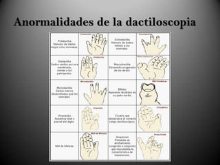 Huellas Dactilares PPTX huellas-dactilares-pptx
