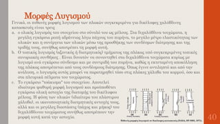 Μορφές Λυγισμού
40
Γενικά, οι πιθανές μορφές λυγισμού των πλακών συγκεκριμένα για δικέλυφες χαλύβδινες
κατασκευές είναι τρεις
a. ο ολικός λυγισμός του στοιχείου στο σύνολό του ως μέλους. Στα διχαλύβδινα τοιχώματα, η
μεγάλη εγκάρσια ροπή αδράνειας λόγω πάχους του πυρήνα, το μεγάλο μέτρο ελαστικότητας των
υλικών και η συνέργεια των υλικών μέσω της προσθήκης των συνδέσμων διάτμησης και της
τριβής τους, συνήθως αποτρέπει τη μορφή αυτή.
b. Ο τοπικός λυγισμός (αξονικός ή διατμητικός) τμήματος της πλάκας υπό συγκεκριμένες τοπικές
συνοριακές συνθήκες . Είναι δυνατόν να συναντηθεί στα διχαλύβδινα τοιχώματα κυρίως με
λυγισμό ανά εγκάρσιο σύνδεσμο και με συντριβή του πυρήνα, καθώς η εκτεταμένη αποκόλληση
της πλάκας αποτρέπεται από τους συνδέσμους διάτμησης. Όπως έγινε αντιληπτό και από την
ανάλυση, ο λυγισμός αυτός μπορεί να παρατηρηθεί τόσο στις πλάκες χάλυβα του κορμού, όσο και
στα πλευρικά πέλματα του τοιχώματος.
c. Το εγκάρσιο "τσάκισμα" του στοιχείου. Αποτελεί
ιδιαίτερα ψαθυρή μορφή λυγισμού και προϋποθέτει
εγκάρσια ολική αστοχία της διατομής του δικέλυφου
μέλους. Η φύση των υλικών (ιδιαίτερα του πλάστιμου
χάλυβα), οι ικανοποιητικές διατμητικές αντοχές τους,
αλλά και οι μεγάλες διαστάσεις (πάχος και μήκος) του
διχαλύβδινου τοιχώματος συνήθως αποτρέπουν την
μορφή αυτή κατά την αστοχία.
 