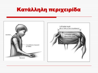 Κατάλληλη περιχειρίδα
 