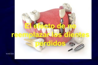 El efecto de no
reemplazar los dientes
perdidos
word.doc
 
