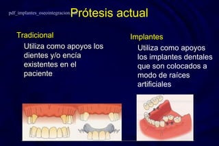 Prótesis actual
TradicionalTradicional
Utiliza como apoyos losUtiliza como apoyos los
dientes y/o encíadientes y/o encía
existentes en elexistentes en el
pacientepaciente
ImplantesImplantes
Utiliza como apoyos
los implantes dentales
que son colocados a
modo de raíces
artificiales
pdf_implantes_oseointegracion.pdf
 