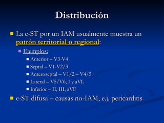 DistribuciónDistribución
 La e-ST por un IAM usualmente muestra unLa e-ST por un IAM usualmente muestra un
patrón territorial o regionalpatrón territorial o regional::
 Ejemplos:Ejemplos:
 Anterior – V3-V4Anterior – V3-V4
 Septal – V1-V2/3Septal – V1-V2/3
 Anteroseptal – V1/2 – V4/5Anteroseptal – V1/2 – V4/5
 Lateral – V5/V6, I y aVLLateral – V5/V6, I y aVL
 Inferior – II, III, aVFInferior – II, III, aVF
 e-ST difusa – causas no-IAM, e.j. pericarditise-ST difusa – causas no-IAM, e.j. pericarditis
 