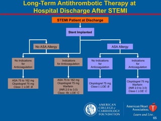Comprehensive Overview of ST-Elevation Myocardial Infarction (STEMI ...