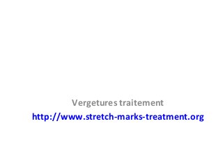 Vergetures traitement
http://www.stretch-marks-treatment.org
 