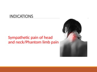 Sympathetic pain of head
and neck/Phantom limb pain
INDICATIONS
 