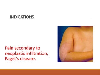 Pain secondary to
neoplastic infiltration,
Paget's disease.
INDICATIONS
 
