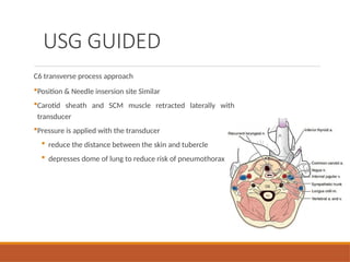 USG GUIDED
C6 transverse process approach
Position & Needle insersion site Similar
Carotid sheath and SCM muscle retracted laterally with
transducer
Pressure is applied with the transducer
 reduce the distance between the skin and tubercle
 depresses dome of lung to reduce risk of pneumothorax
 