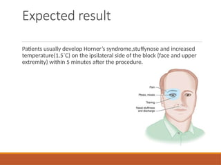 Expected result
Patients usually develop Horner’s syndrome,stuffynose and increased
temperature(1.5`C) on the ipsilateral side of the block (face and upper
extremity) within 5 minutes after the procedure.
 