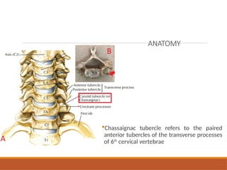 ANATOMY
Chassaignac tubercle refers to the paired
anterior tubercles of the transverse processes
of 6th
cervical vertebrae
 