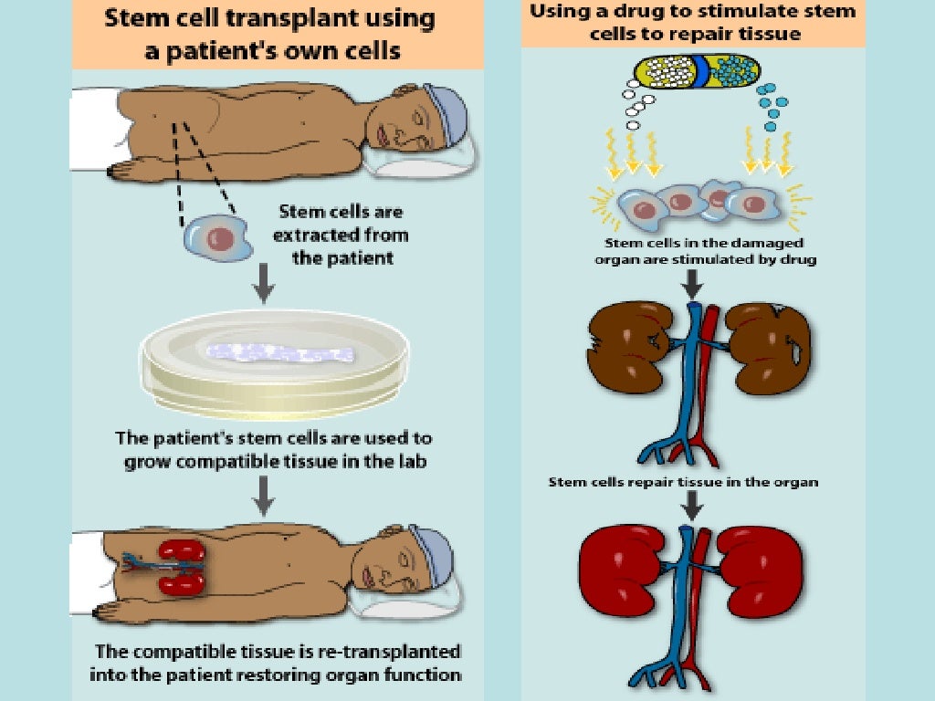 stem cell meaning stem cell meaning
