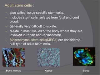 Adult stem cells :
• also called tissue specific stem cells.
• includes stem cells isolated from fetal and cord
blood.
• generally very difficult to isolate.
• reside in most tissues of the body where they are
involved in repair and replacement.
• Mesenchymal stem cells(MSCs) are considered
sub type of adult stem cells.
Bone marrow Kidney Lung
 