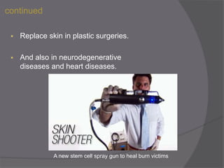 continued
 Replace skin in plastic surgeries.
 And also in neurodegenerative
diseases and heart diseases.
A new stem cell spray gun to heal burn victims
 