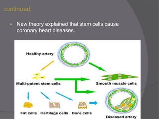 continued
 New theory explained that stem cells cause
coronary heart diseases.
 