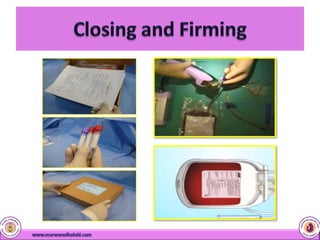 Cord Blood Stem Cells | PDF