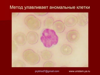 Метод улавливает аномальные клетки

prykhod7@gmail.com

www.unistem.ya.ru

 