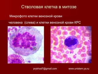Стволовая клетка в митозе
Микрофото клетки венозной крови
человека (слева) и клетки венозной крови КРС

prykhod7@gmail.com

www.unistem.ya.ru

 