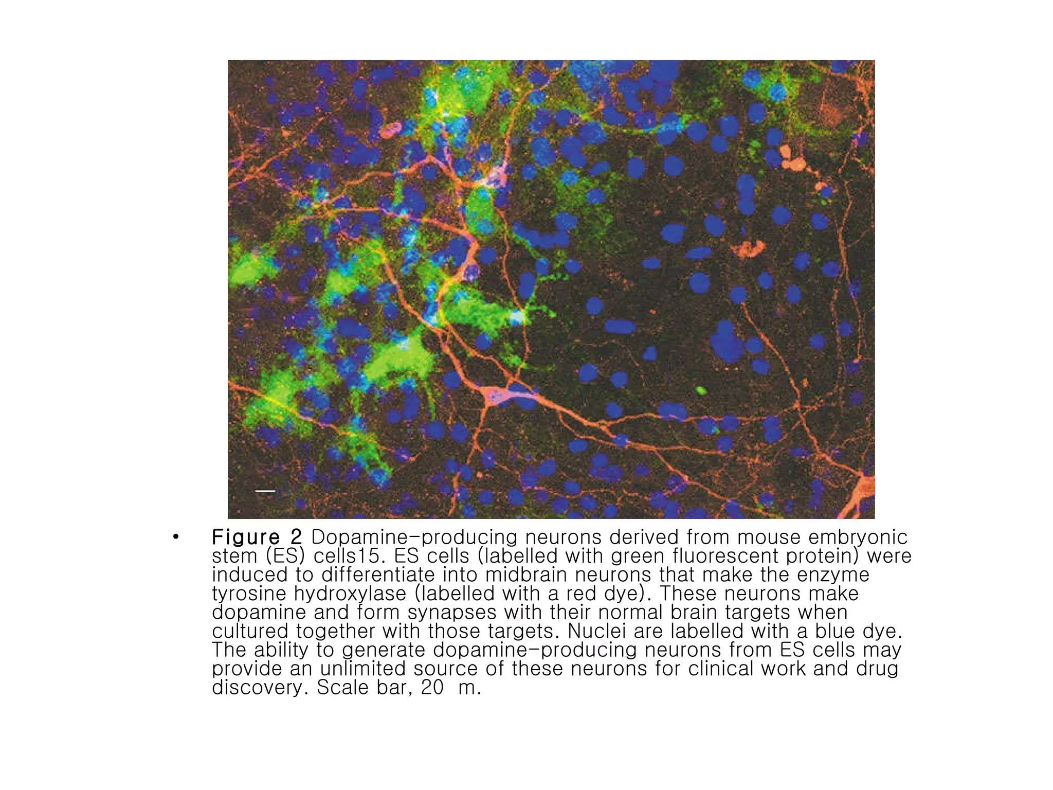 Figure 2  Dopamine-producing neurons derived from mouse embryonic stem (ES) cells15. ES cells (labelled with green fluorescent protein) were induced to differentiate into midbrain neurons that make the enzyme tyrosine hydroxylase (labelled with a red dye). These neurons make dopamine and form synapses with their normal brain targets when cultured together with those targets. Nuclei are labelled with a blue dye. The ability to generate dopamine-producing neurons from ES cells may provide an unlimited source of these neurons for clinical work and drug discovery. Scale bar, 20  m.  