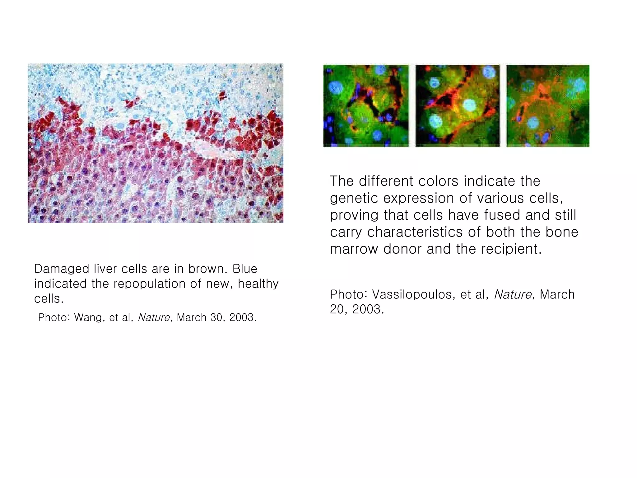 Damaged liver cells are in brown. Blue indicated the repopulation of new, healthy cells.    Photo: Wang, et al,  Nature , March 30, 2003.   The different colors indicate the genetic expression of various cells, proving that cells have fused and still carry characteristics of both the bone marrow donor and the recipient.   Photo: Vassilopoulos, et al,  Nature , March 20, 2003. 