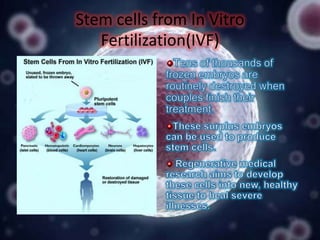 Stem cells from In Vitro
Fertilization(IVF)

 