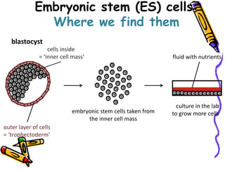 Embryonic stem (ES) cells:
Where we find them
blastocyst
outer layer of cells
= ‘trophectoderm’
cells inside
= ‘inner cell mass’
embryonic stem cells taken from
the inner cell mass
culture in the lab
to grow more cells
fluid with nutrients
 