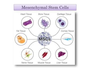Mesenchymal Stem Cells
 