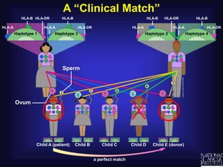 A “Clinical Match”
Child A (patient)
HLA-A
HLA-B
Child E (donor)
a perfect match
Child D
Haplotype 3
Child C
Sperm
Ovum
Child B
Haplotype 1
HLA-A HLA-DR
HLA-B
HLA-DR
HLA-A
HLA-B
Haplotype 4
Haplotype 2
HLA-A HLA-DR
HLA-B
HLA-DR
 