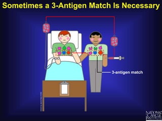 Sometimes a 3-Antigen Match Is Necessary
3-antigen match
 
