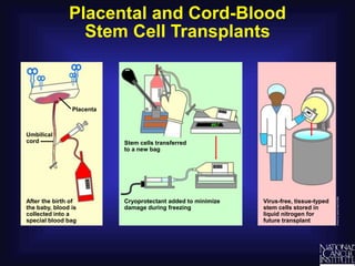 Placental and Cord-Blood
Stem Cell Transplants
After the birth of
the baby, blood is
collected into a
special blood bag
Umbilical
cord
Placenta
Virus-free, tissue-typed
stem cells stored in
liquid nitrogen for
future transplant
Cryoprotectant added to minimize
damage during freezing
Stem cells transferred
to a new bag
 