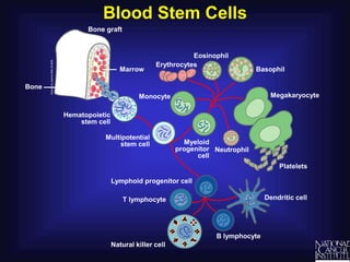 Blood Stem Cells
Bone graft
Multipotential
stem cell
Hematopoietic
stem cell
Platelets
Erythrocytes
Eosinophil
Neutrophil
Megakaryocyte
Basophil
T lymphocyte
Natural killer cell
Dendritic cell
B lymphocyte
Lymphoid progenitor cell
Myeloid
progenitor
cell
Monocyte
Marrow
Bone
 