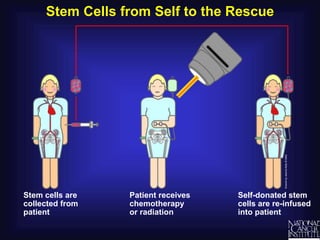 Stem Cells from Self to the Rescue
Patient receives
chemotherapy
or radiation
Self-donated stem
cells are re-infused
into patient
Stem cells are
collected from
patient
 