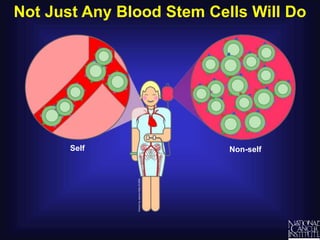 Not Just Any Blood Stem Cells Will Do
Self Non-self
 